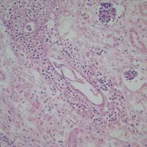 Kidney showing hematopoiesis around a vessel, H&E 20x