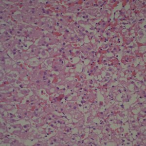 Early evidence of involution of the fetal zone 40x