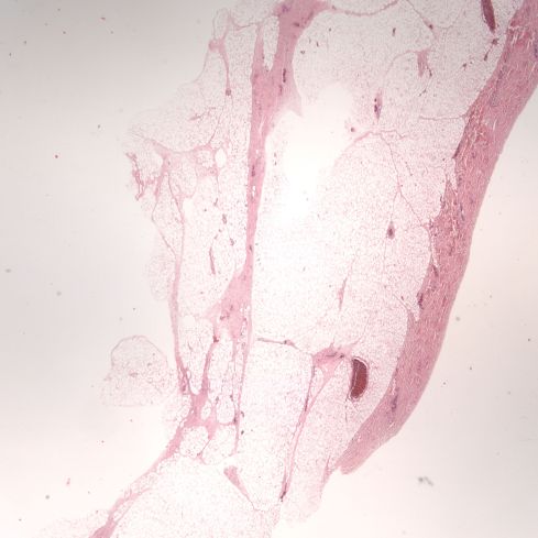 Fig 1 CA00-65_2xskin