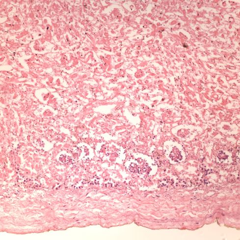 Fig 1 CA02-94_20xkid