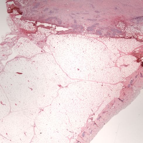 Fig 1 CA10-52_2xskin