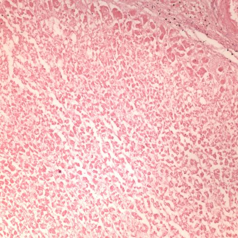 Fig 2 CA02-94_20xadr