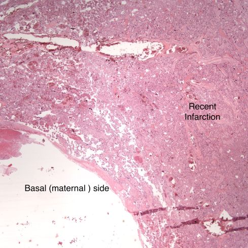 fig 2 CA98-26_2xplac