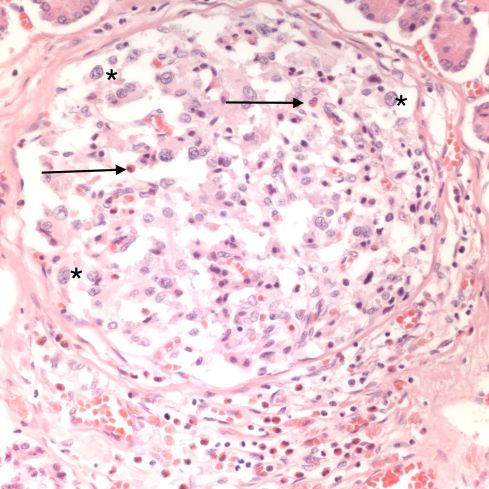 fig 3 CA01-22_40xpancr