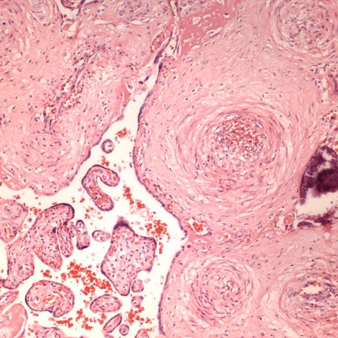 Fig 3 CA02-94_20xvilli vasc