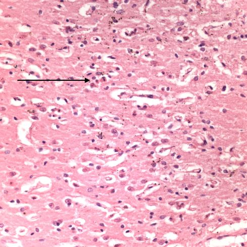 Fig 3 CA98-26_40xhippo