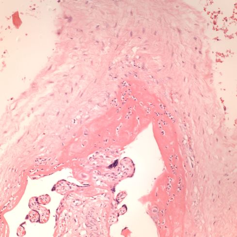 Fig 4 CA02-94_20xsciv