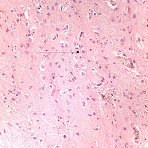 fig 4CA98-26_40xpons