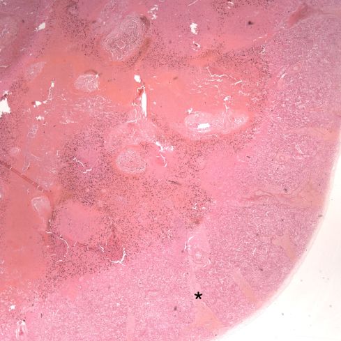 Fig 5 CA00-65_2xlung