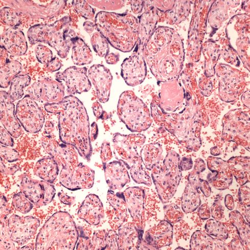 fig 7 CA98-26_20x villi