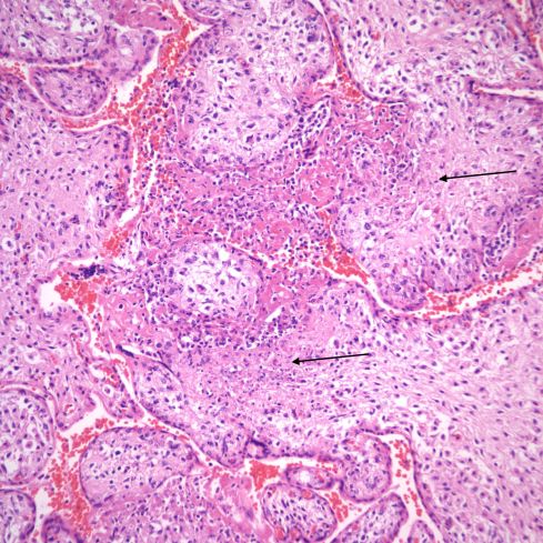 Ob 10a fig 54 5862toxo